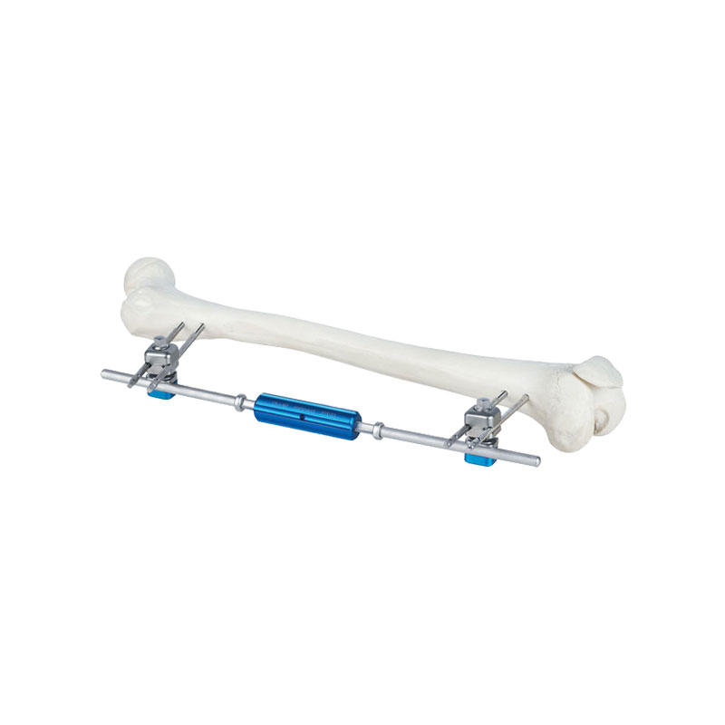 Thighbone pressure connecting rod (single-rod) single-side frame