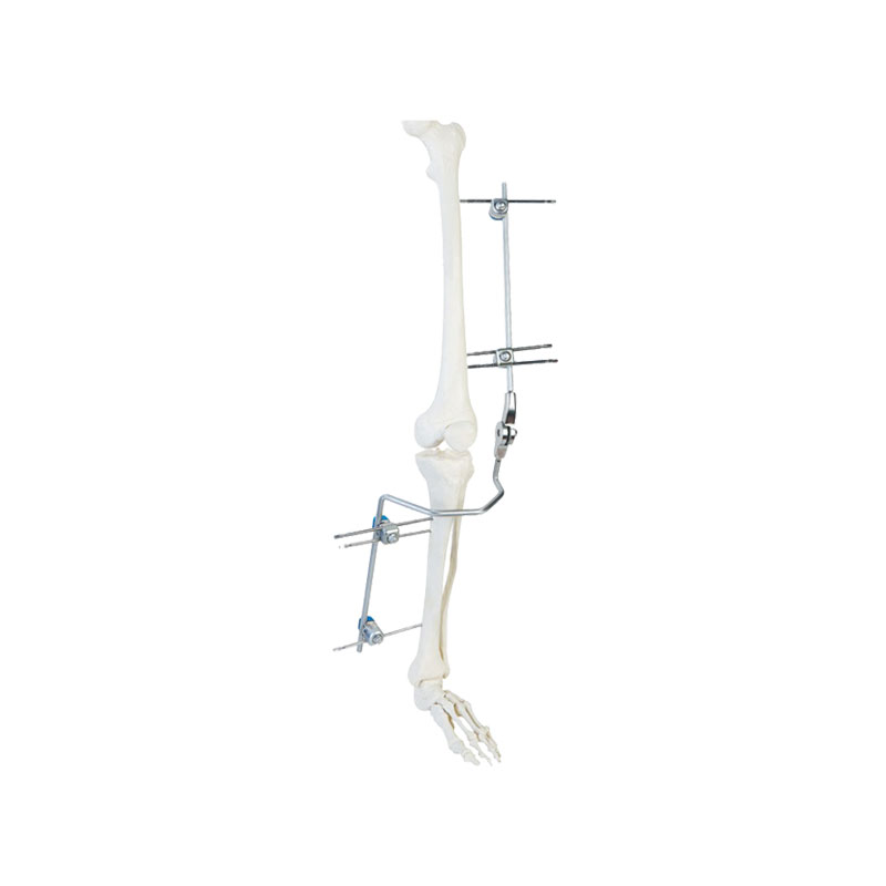Knee joint frame